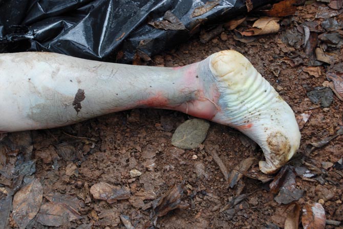 the body farm tennessee